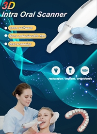 3D Intra Oral Scanner