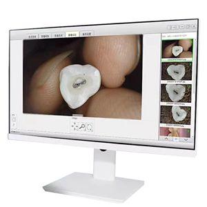 LK-I35 Touch Screen  Endoscope System